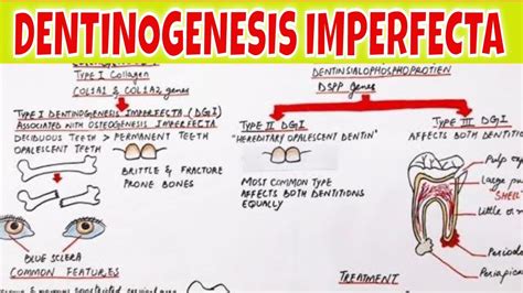 Dentinogenesis Imperfecta - Pathogenesis, Types, Clinical features and Treatment - YouTube