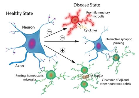 Microglia And Neurodegenerative Diseases