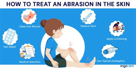 Abrasion: Types, Symptoms, Treatment - Ongo Care