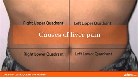 Liver Pain - Location, Causes and Treatment - YouTube