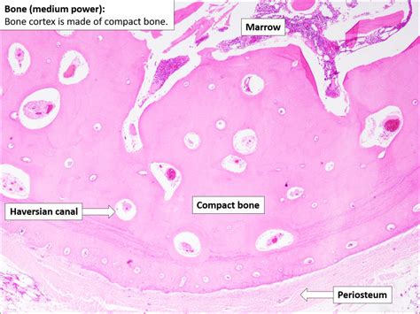 Bone – Normal Histology – NUS Pathweb :: NUS Pathweb