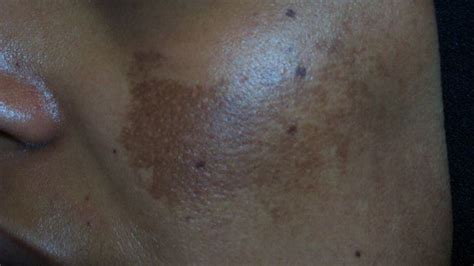 All About Common Skin Disorders - Bacana