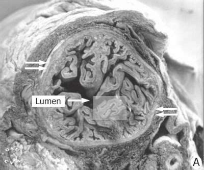 Oviduct Histology - Oviduct, mouse (labels) - SEM