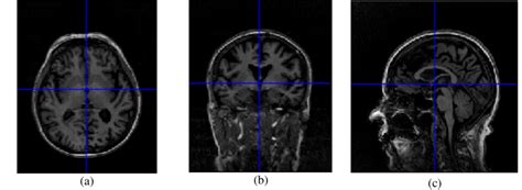 MRI Centered at Anterior Cingulate Cortex Position: (a) Axial, (b ...