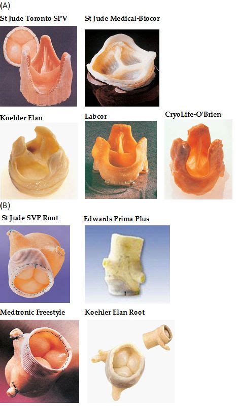 Stentless Bioprostheses for Aortic Valve Replacement in Calcific Aortic ...