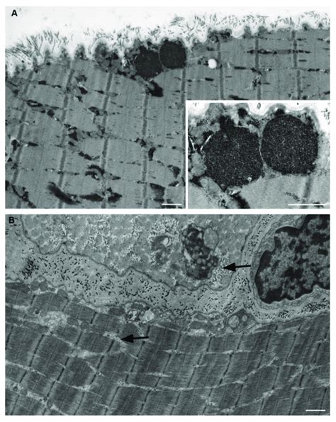 Electron microscopy of muscle fibers in longitudinal section of a ...