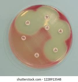 Red Pigment Serratia Marcescens On Muellerhinton Stock Photo 1228913548 ...