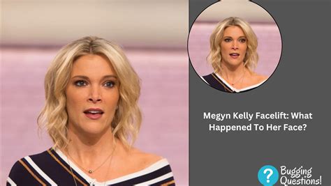 Megyn Kelly Facelift: What Happened To Her Face? Before And After Pics And Age – Bugging Questions