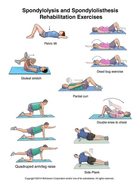 xspondyl_3.jpg 744×963 pixels | Physical Therapy? | Pinterest | Medical ...