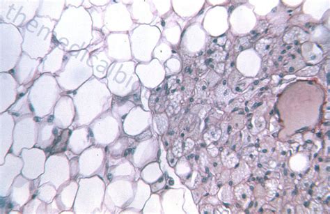 Adipose Tissue: Not Just Fat - The Medical Biochemistry Page