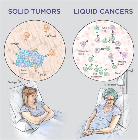 Figure From Innovative Car T Cell Therapy For Solid Tumor Current | Hot Sex Picture