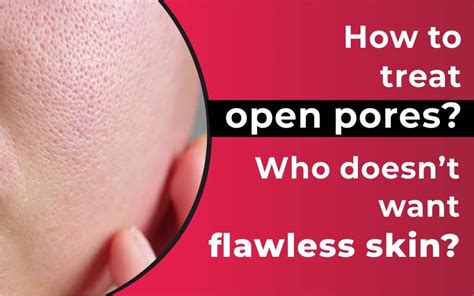 Open Pores, How to treat Open Pores, Treatments for Open Pores, According to Dermatology, Causes ...