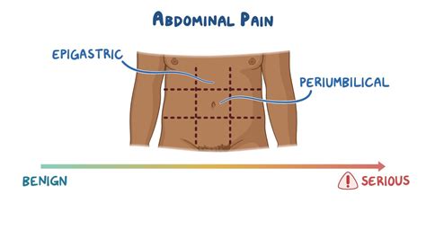 Approach to periumbilical and lower abdominal pain: Clinical sciences ...