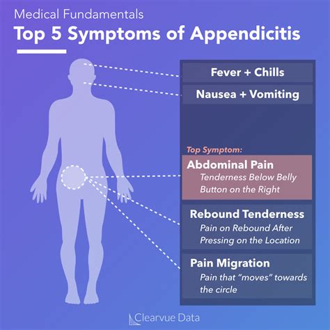 The Data on Appendicitis Without Surgery