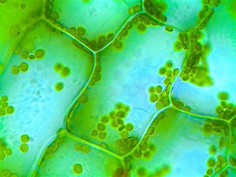 Elodea water plant under microscope. Cell walls and chloroplasts are clearly vis , #Sponsored, # ...