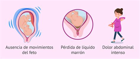 Muerte fetal intrauterina: síntomas, causas y apoyo emocional (2022)