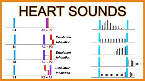 Heart Sounds Diagram S1 S2