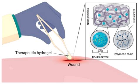 Gels | Free Full-Text | Nanoclay/Polymer-Based Hydrogels and Enzyme ...