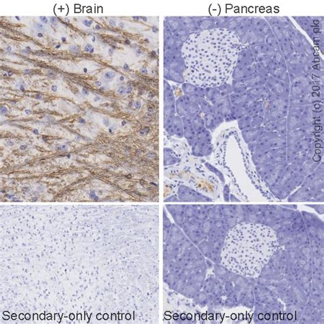 Anti-Myelin Basic Protein antibody [22] (ab11223) | Abcam