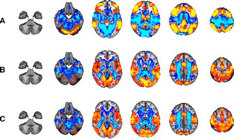 fMRI Analysis of Brain Network Connectivity during Adolescence ...