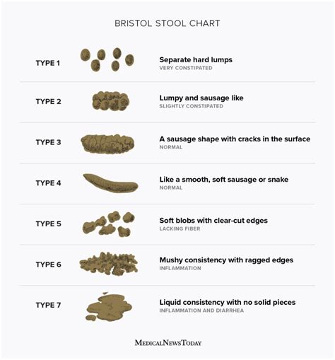 Bristol Stool scale: Stool types and what they mean