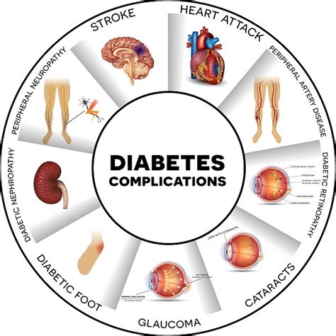 Preventing Diabetes Complications & Health Problems