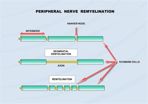 Schwann Cell Plasticity in Peripheral Nerve Regeneration after Injury | IntechOpen