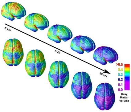 Development - The Frontal Lobe