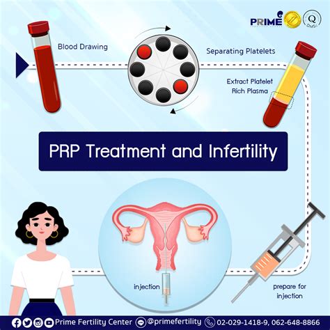 PRP Treatment and Infertility | Thailand IVF/ICSI/IUI