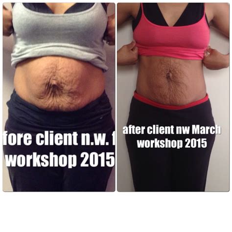 All New Before and After Pictures – Healing the Diastasis Recti 2015 – Beautiful After the Belly