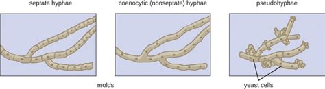 Mold: characteristics, types of hyphae and examples - Online Biology Notes