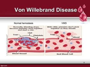 Is there any Relationship between Rh(D) Blood Group and Von Willebrand ...