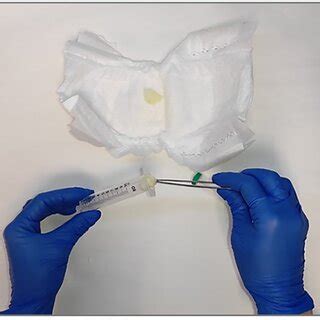 Infants’ urine sample collection procedure. Sterile cotton pads are ...