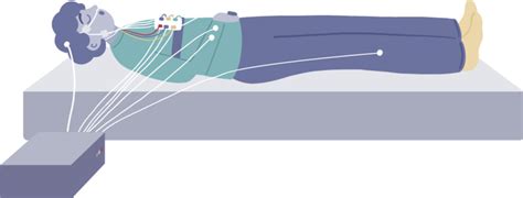 An illustration of the location of the various electrodes and sensors... | Download Scientific ...