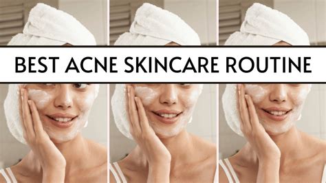 The Lazy Easy Acne Skincare Routine You'll Ever Try! (2021)