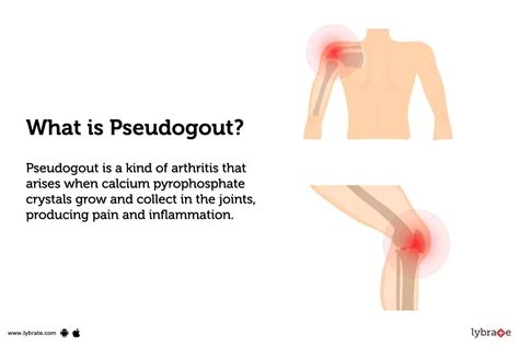 Pseudogout