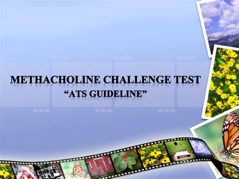 PPT - MethacholinE challenge test “ Ats guideline” PowerPoint ...