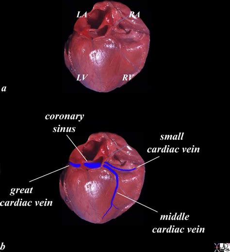 Venous Drainage | Heart