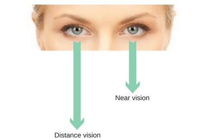 Contact Lens Trials before Lens Surgery