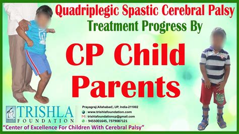 Quadriplegic Spastic Cerebral Palsy Treatment Progress By CP Child ...