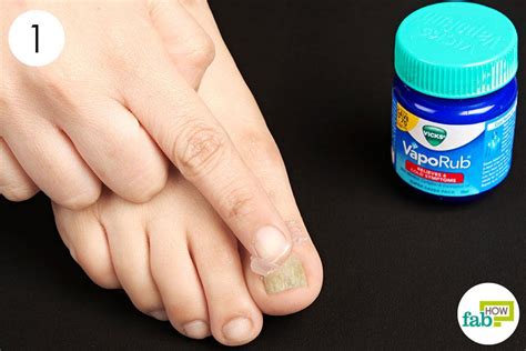 How to Get Rid of Toenail Fungus | Fab How