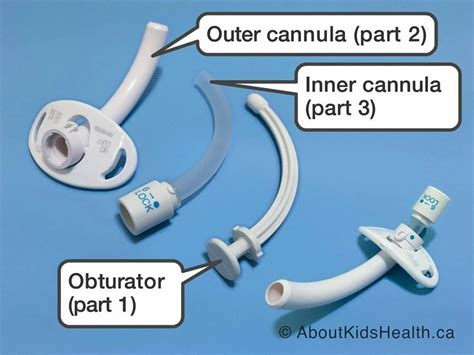 Adjustable Cuffed Tracheostomy Tube Inner Cannula at Rs 4600/piece in Ghaziabad