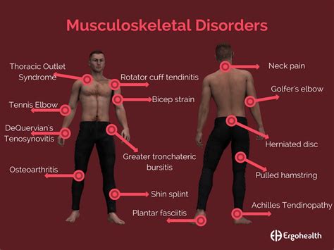 Managing Musculoskeletal Disorders at Work – Part One - Options HR brochure and blogOptions HR ...