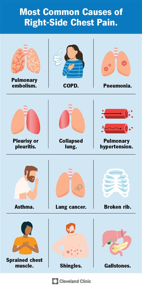 12 Causes of Right-Sided Chest Pain