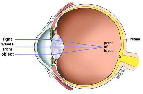 Myopia - The Human Eye