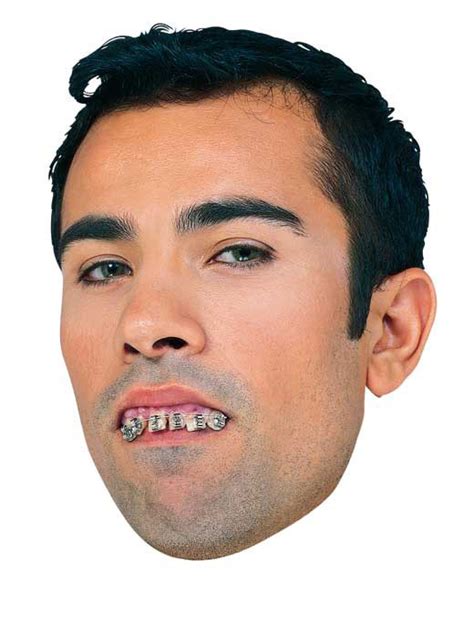 Fake Teeth With Braces - $5.95 : FunSlurp.com, Unique Gifts and Fun ...