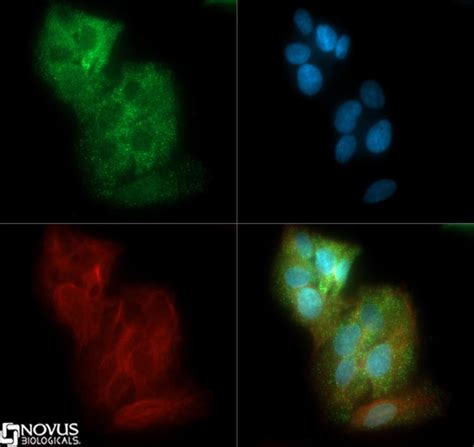 Anti-SLC2A2 / GLUT2 Antibody | Rabbit anti-Human Polyclonal | LSBio