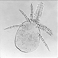 Trombiculidae - Wikipedia