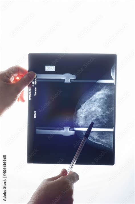 Cropped hands of medical woman examining mammogram X-ray of right ...