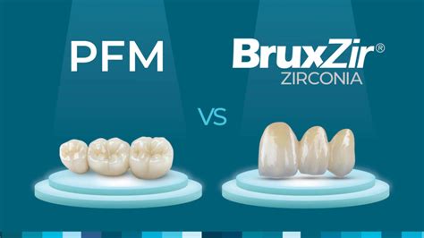 Zirconia Versus PFMs: Which Should You Crown the Winner?